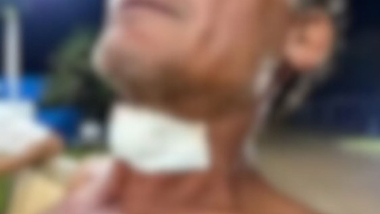 Vítima com curativo no pescoço após o atendimento no hospital. — Foto: Vítima co