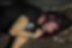 Foto: Vítima teria sofrido traumatismo craniano. (Foto: Leitor Midiamax)