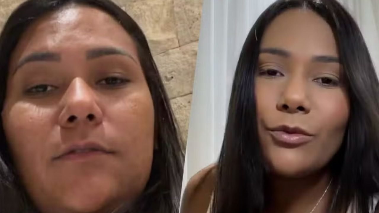 Chaiany mostra antes e depois de procedimento estético. (Foto: Reprodução/Gshow)