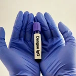 Dengue - Foto: Shutterstock