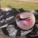 Foto: Motoentregador foi agredido por dois homens durante o assalto -Foto: Arqui