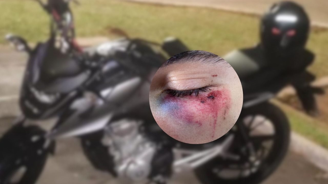 Foto: Motoentregador foi agredido por dois homens durante o assalto -Foto: Arqui