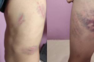 Foto: Criança foi agredida enquanto estava no ponto de ônibus. (Foto: Fala Povo,