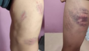 Foto: Criança foi agredida enquanto estava no ponto de ônibus. (Foto: Fala Povo,