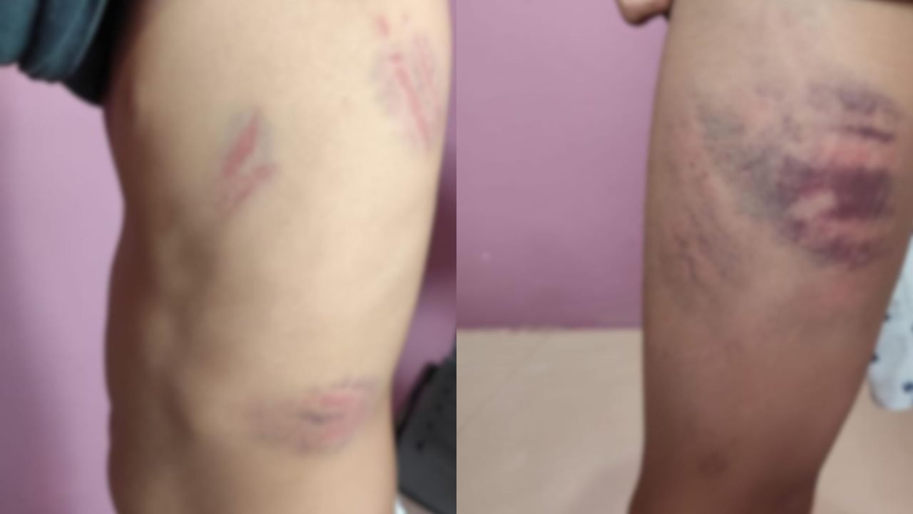 Foto: Criança foi agredida enquanto estava no ponto de ônibus. (Foto: Fala Povo,