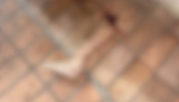 Foto: Perna arrancada. (Fala Povo, Jornal Midiamax)