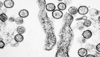 hantavirus