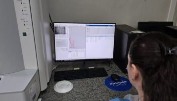 hospital-regional-de-ms-acelera-diagnosticos-com-nova-tecnologia