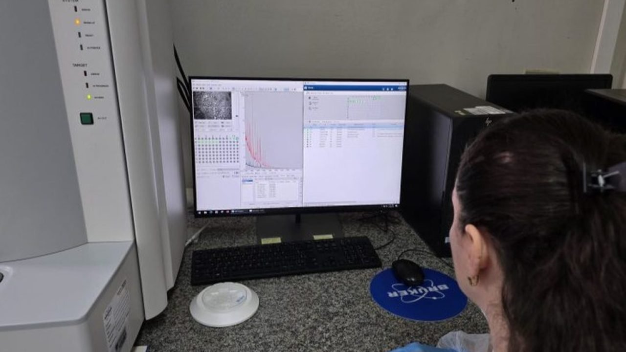 hospital-regional-de-ms-acelera-diagnosticos-com-nova-tecnologia