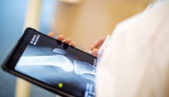 Café ou chá: qual fortalece e qual enfraquece seus ossos?